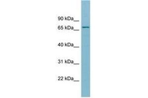 Image no. 1 for anti-Solute Carrier Family 27 (Fatty Acid Transporter), Member 5 (SLC27A5) (AA 611-660) antibody (ABIN6741651) (SLC27A5 antibody  (AA 611-660))