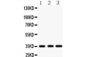 Western Blotting (WB) image for anti-Insulin-Like Growth Factor Binding Protein 2, 36kDa (IGFBP2) (AA 228-257), (C-Term) antibody (ABIN3043858)