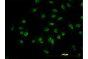 Immunofluorescence (IF) image for anti-C1D Nuclear Receptor Corepressor (C1D) (AA 1-141) antibody (ABIN564544)