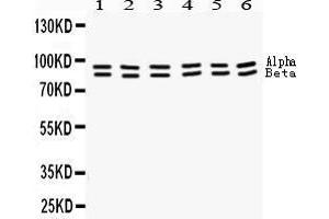 Western Blotting (WB) image for anti-Signal Transducer and Activator of Transcription 1, 91kDa (STAT1) (AA 114-143), (N-Term) antibody (ABIN3043938) (STAT1 antibody  (N-Term))