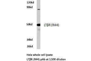 Western blot (WB) analysis of LTβR antibody in extracts from HeLa cells. (LTBR antibody)