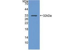 Western blot analysis of the recombinant protein. (Integrin alpha 1 antibody  (AA 125-366))