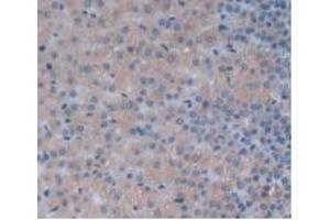 Detection of IL24 in Rat Adrenal Gland Tissue using Monoclonal Antibody to Interleukin 24 (IL24) (IL-24 antibody  (AA 29-183))