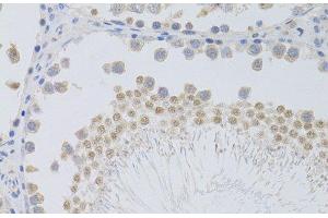 Immunohistochemistry of paraffin-embedded Rat testis using PHC1 Polyclonal Antibody at dilution of 1:100 (40x lens). (PHC1 antibody)