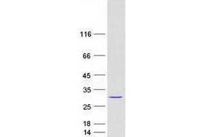 Validation with Western Blot (PYCARD Protein (Transcript Variant 1) (Myc-DYKDDDDK Tag))