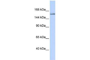 WB Suggested Anti-NCOA3 Antibody Titration:  0. (NCOA3 antibody  (Middle Region))