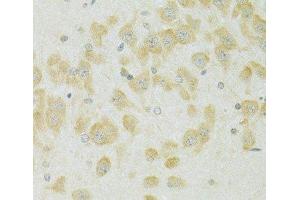 Immunohistochemistry of paraffin-embedded Rat brain using SLC37A4 Polyclonal Antibody at dilution of 1:100 (40x lens). (SLC37A4 antibody)