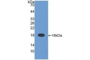 Western Blotting (WB) image for alpha-Fetoprotein (AFP) ELISA Kit (ABIN6720555)