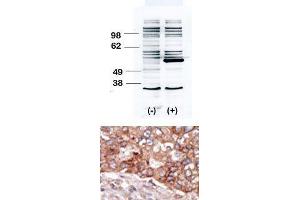 Image no. 2 for anti-B Lymphoid Tyrosine Kinase (BLK) (N-Term) antibody (ABIN359972) (BLK antibody  (N-Term))
