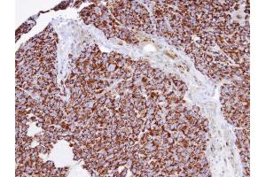 Immunohistochemistry (IHC) image for anti-Inositol Polyphosphate-1-Phosphatase (INPP1) antibody (ABIN2856175)