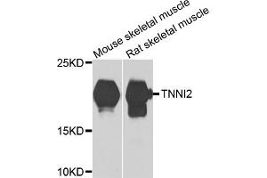 Western blot analysis of extracts of various cell lines, using TNNI2 antibody (ABIN5975229) at 1/1000 dilution. (TNNI2 antibody)