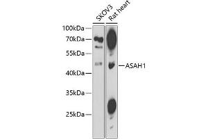 Western blot analysis of extracts of various cell lines, using  antibody  at 1:1000 dilution. (ASAH1 antibody  (AA 140-389))