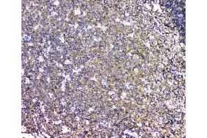 IHC analysis of LCP1 using anti-LCP1 antibody (ABIN6719421). (LCP1 antibody)