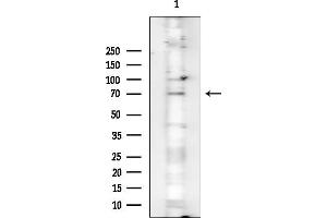 anti-Tripartite Motif Containing 32 (TRIM32) (Internal Region) antibody