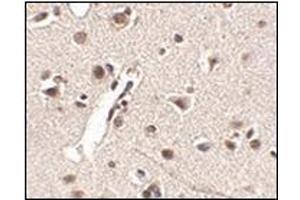 Immunohistochemistry of Rkhd4 in human brain tissue with this product at 2. (MEX3A antibody  (C-Term))