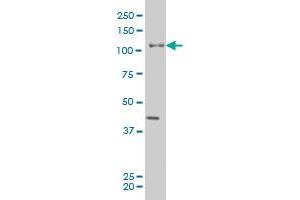 EPHB3 monoclonal antibody (M04), clone 2G8 Western Blot analysis of EPHB3 expression in A-431 . (EPH Receptor B3 antibody  (AA 899-997))