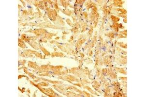 Immunohistochemistry of paraffin-embedded human heart tissue using ABIN7167709 at dilution of 1:100 (RGMA antibody  (AA 153-408))