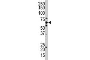 The UBQLN2 polyclonal antibody  is used in Western blot to detect UBQLN2 in HeLa cell lysate. (Ubiquilin 2 antibody  (C-Term))