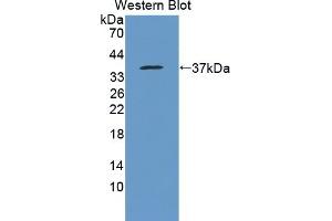 Detection of Recombinant HCCS, Human using Polyclonal Antibody to Holocytochrome C Synthase (HCCS)