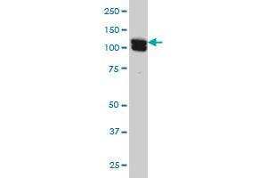 HCAP-G monoclonal antibody (M01), clone 4B1 Western Blot analysis of HCAP-G expression in HeLa . (NCAPG antibody  (AA 336-435))