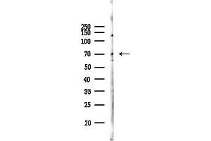Western blot analysis of lysates from Hela cells(starvation 24h treatment), using PRDM14 Antibody at 1/1000 dilution.