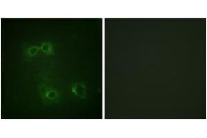 Immunofluorescence analysis of COS7 cells, using FAS (Phospho-Tyr291) Antibody. (FAS antibody  (pTyr291))