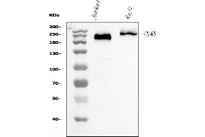Western blot analysis of CD45 using anti-CD45 antibody (ABIN7602775).