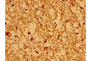 Immunohistochemistry of paraffin-embedded human brain tissue using ABIN7145127 at dilution of 1:100 (AXIN2 antibody  (AA 11-77))