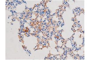 Immunohistochemistry (IHC) image for anti-Insulin Receptor Substrate 1 (IRS1) (pSer639) antibody (ABIN6256390)