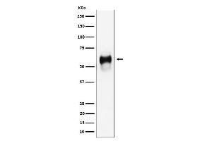 Western blot analysis of CD58 expression in Raji cell lysate. (Recombinant CD58 antibody)