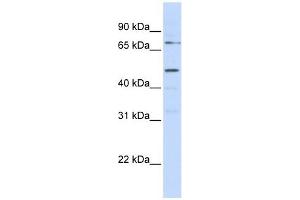 KREMEN1 antibody used at 1 ug/ml to detect target protein. (KREMEN1 antibody  (N-Term))