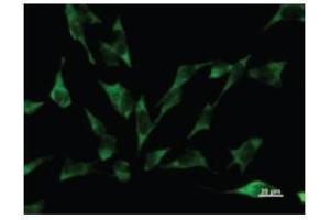 Immunostaining analysis in HeLa cells. (YARS antibody)