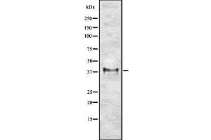 Western blot analysis of ETV2 using K562 whole cell lysates (ETV2 antibody  (Internal Region))