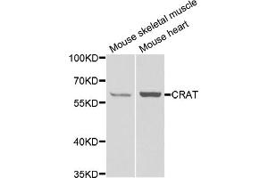 Western blot analysis of extracts of various cell lines, using Crat antibody (ABIN5973772) at 1/1000 dilution. (CRAT antibody)