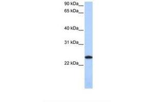 Image no. 1 for anti-Ferritin, Light Polypeptide (FTL) (C-Term) antibody (ABIN6749757) (FTL antibody  (C-Term))