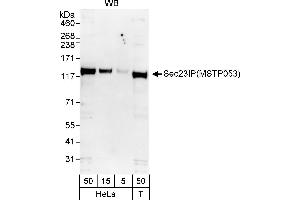 Western Blotting (WB) image for anti-SEC23 Interacting Protein (SEC23IP) (AA 350-400) antibody (ABIN7453874)