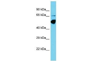 Host: Rabbit Target Name: CCDC41 Sample Type: COLO205 Whole Cell lysates Antibody Dilution: 1. (CCDC41 antibody  (N-Term))