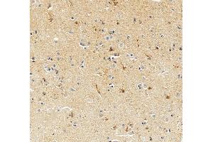 IHC analysis of KCC2/SLC12A5 using anti-KCC2/SLC12A5 antibody (ABIN6719415).