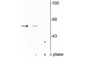 Western blot of rat cortical lysate showing specific immunolabeling of the ~62 kDa synaptotagmin phosphorylated at Thr202 in the first lane (-). (SYT1 antibody  (pSer309))
