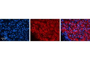 Rabbit Anti-EIF4G2 Antibody   Formalin Fixed Paraffin Embedded Tissue: Human Liver Tissue Observed Staining: Cytoplasm in hepatocytes Primary Antibody Concentration: 1:100 Other Working Concentrations: N/A Secondary Antibody: Donkey anti-Rabbit-Cy3 Secondary Antibody Concentration: 1:200 Magnification: 20X Exposure Time: 0. (EIF4G2 antibody  (N-Term))