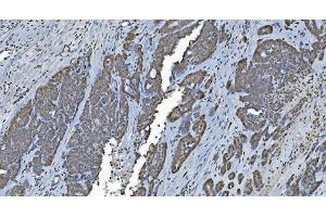 IHC analysis of GRX2/GLRX2 using anti-GRX2/GLRX2 antibody (ABIN7599022).