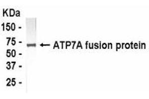 Western Blotting (WB) image for anti-ATPase, Cu++ Transporting, alpha Polypeptide (ATP7A) (AA 1407-1500) antibody (ABIN2467776) (ATP7A antibody  (AA 1407-1500))