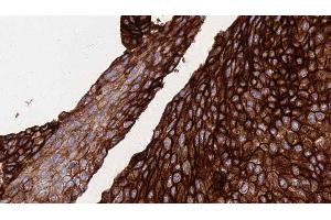 Immunohistochemistry (IHC) image for anti-Fatty Acid Synthase (FASN) (N-Term) antibody (ABIN6261684)