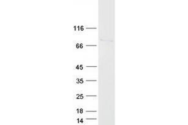 UROC1 Protein (Myc-DYKDDDDK Tag)