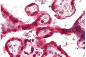 Human Placenta (formalin-fixed, paraffin-embedded) stained with SLC9A3R1 antibody ABIN239821 at 5 ug/ml followed by biotinylated anti-mouse IgG secondary antibody ABIN481714, alkaline phosphatase-streptavidin and chromogen.