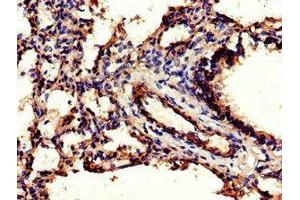Immunohistochemistry of paraffin-embedded human lung tissue using ABIN7147080 at dilution of 1:100 (CEBPB antibody  (AA 41-270))