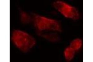 ABIN6275535 staining  HepG2 cells by IF/ICC. (PLK3 antibody  (Internal Region))