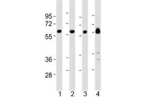 Western blot testing of Lyn antibody at 1:2000 dilution and mouse samples: Lane 1: kidney lysate; 2: heart lysate; 3: ovary lysate; 4: skeletal muscle lysate; Predicted molecular weight 56/58 kDa (isoforms 1/2). (LYN antibody  (AA 229-263))