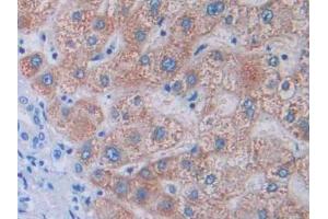 DAB staining on IHC-P; Samples: Human Liver Tissue (Tyrosine Protein Kinase 7 (AA 853-1070) antibody)