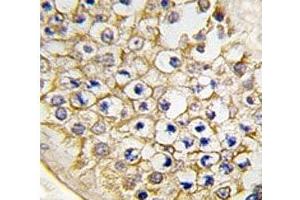 IHC analysis of FFPE human testis tissue stained with TRPV3 antibody